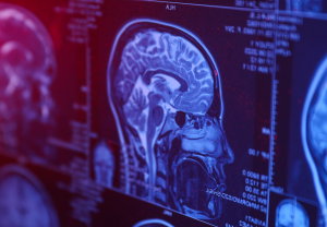 a blue MRI of a brain, showing sections responsible for answering the question how is testosterone produced in men